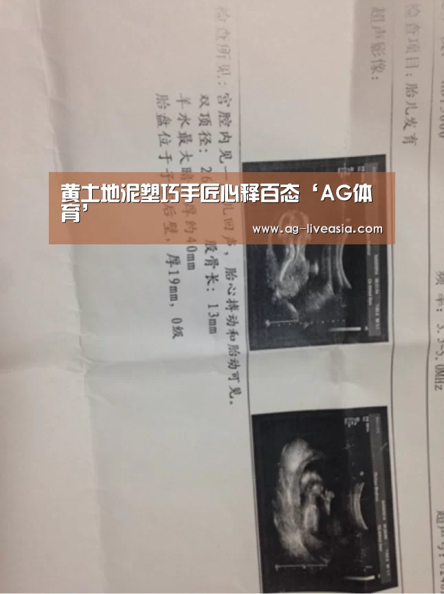 AG赛事